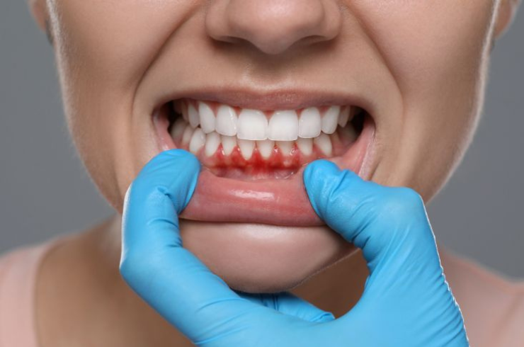 Periodontics